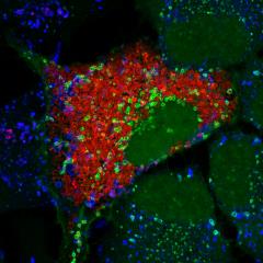 Confocal microscope image of a Brucella abortus-infected HeLa cell showing extensive intracellular bacterial replication and formation of egress vacuoles.