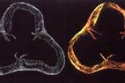 Brightfield images of mouse aorta