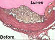 Mouse Aorta premicrodissection