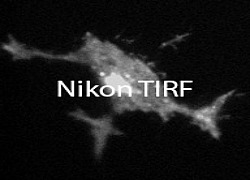 TIRFtext250x180 TIRFtext250x180