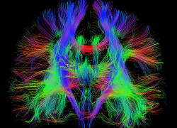 Whole brain tractography