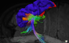 Neuroimaging Pic 2