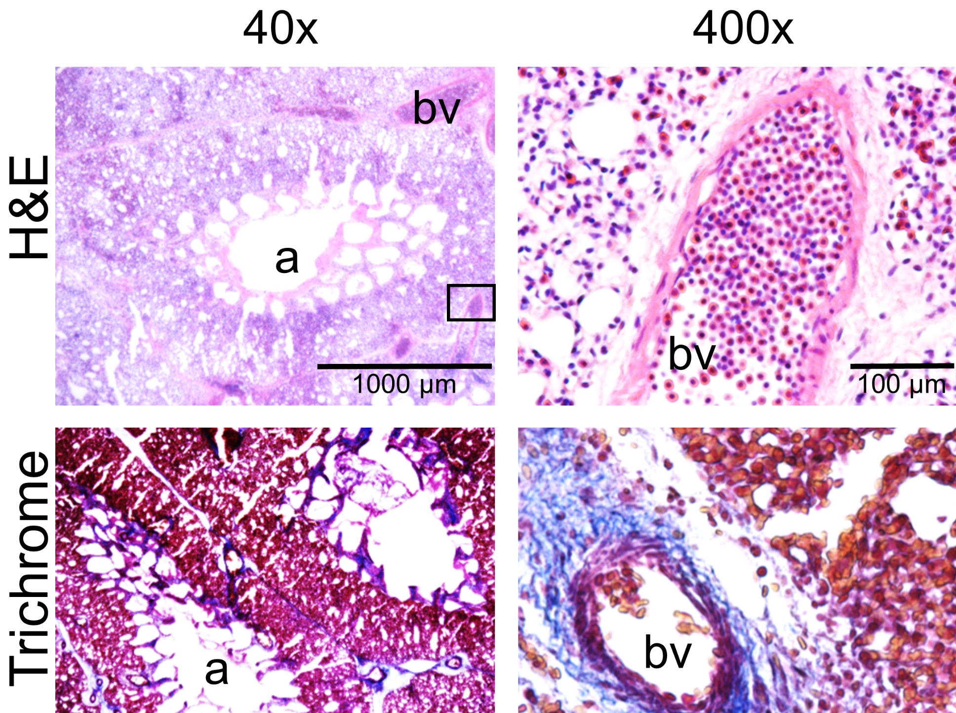 University Of Vermont Medical School >> Next Generation of Lung Stem Cell Research Takes Flight University Of Vermont Medical School >> Next Generation of Lung Stem Cell Research Takes Flight