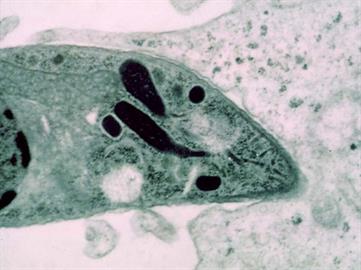 Parasite invading a fibroblast (transmisison electron microscopy).