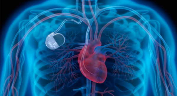 Infeld Meyer Heart heart drawing from JAMA Cardiology research journal