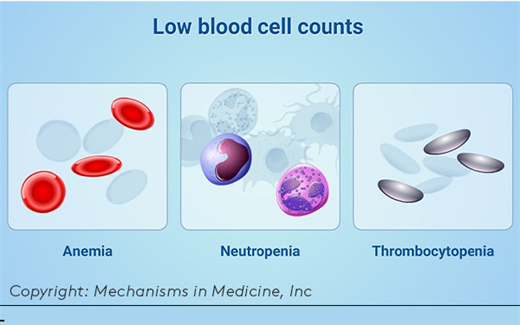 graphic of low blood cell counts
