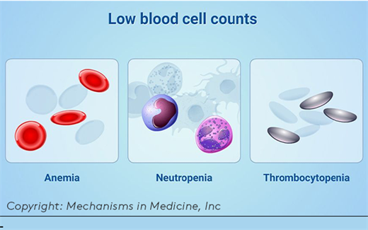 low blood cell count graphic of low blood cell count types