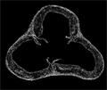 Mouse aorta Sytox Green fluorescence