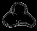 Mouse aorta Sytox Green fluorescence Mouse aorta Sytox Green fluorescence