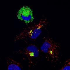 Salmonella-infected epithelial cells