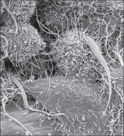 Scanning electron micrograph showing budding of a filamentous strain of influenza A virus from the surface of 293-T cells at 16 h postinfection. Bundles of multiple filamentous virions, some more than 10 μm in length, can be seen protruding from cell surfaces.